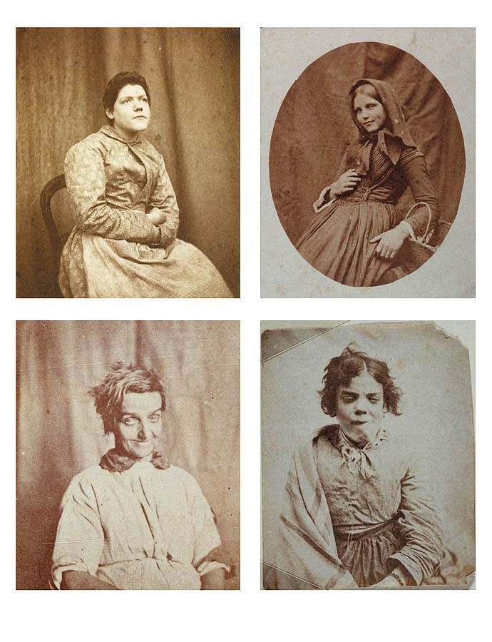 Portrety pacjentek z Surrey County asylum, około 1855, fot. H. W. Diamond.
